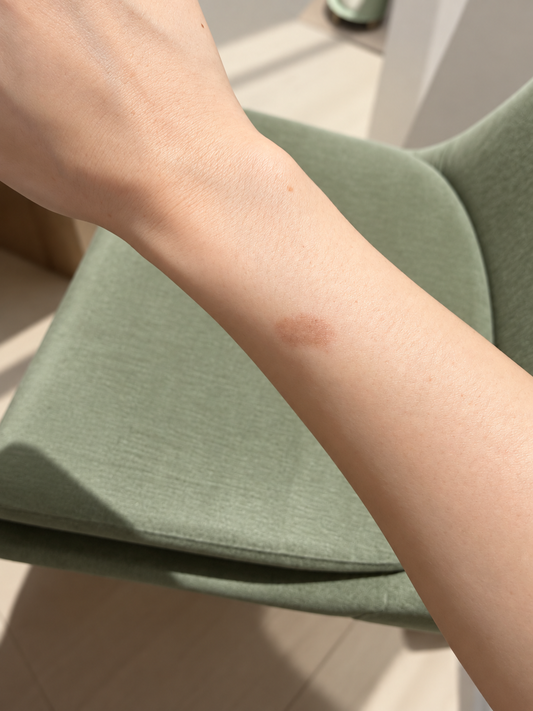 Burn Marks on Your Skin: Why They Stay Dark — and How to Fade Them